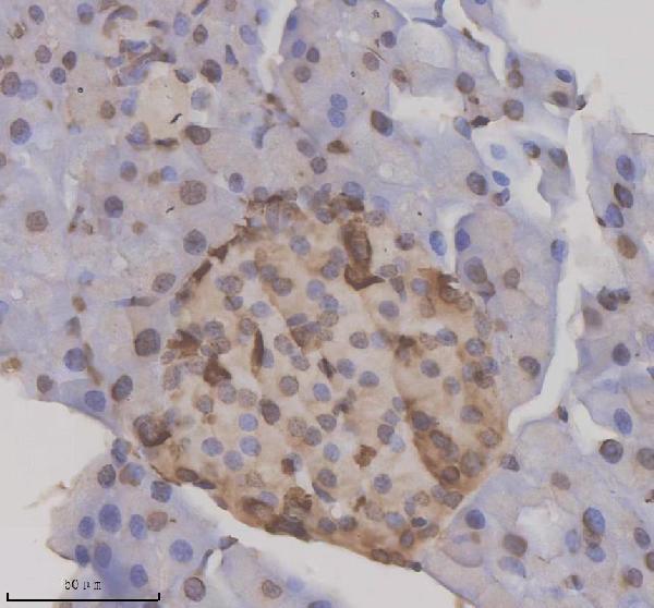 a03729 2 nupr1 primary antibodies ihc testing 3