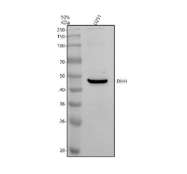Western blot analysis of DHH using anti-DHH antibody (A03731-1)