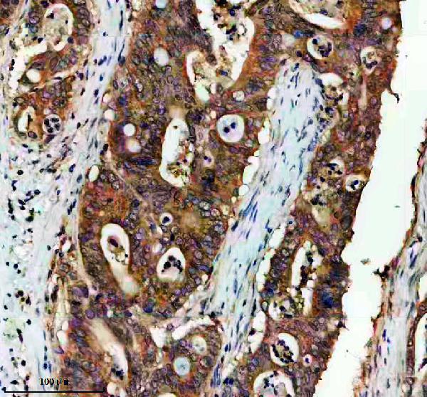 IHC analysis of ADSL using anti-ADSL antibody (A03732-1)