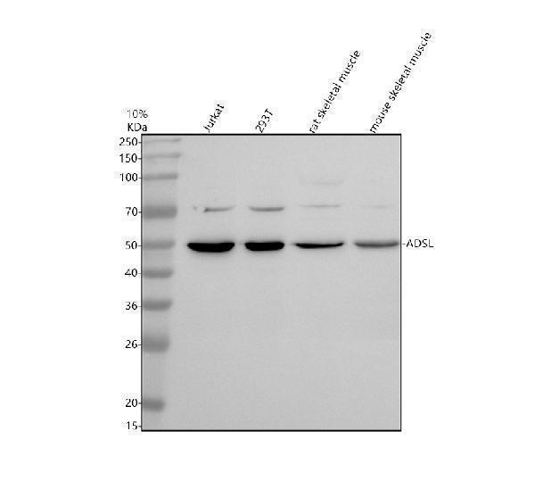 Western blot analysis of ADSL using anti-ADSL antibody (A03732-1)