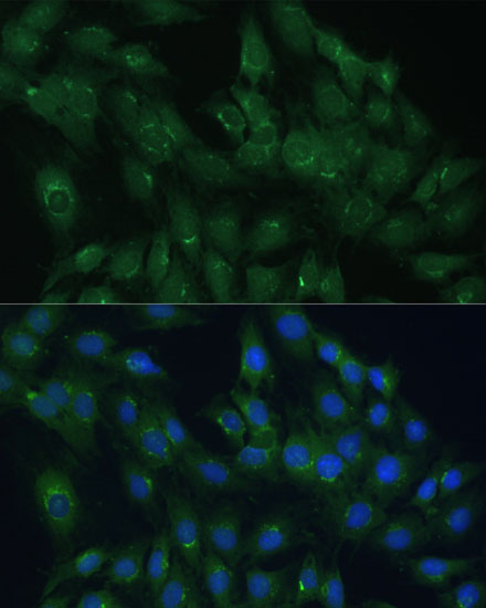 Immunofluorescence analysis of C6 cells using ARL1 Polyclonal Antibody  at dilution of 1:100 