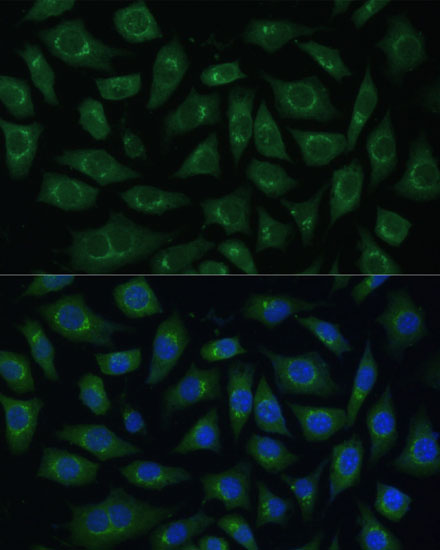 Immunofluorescence analysis of L929 cells using ARL1 Polyclonal Antibody  at dilution of 1:100 