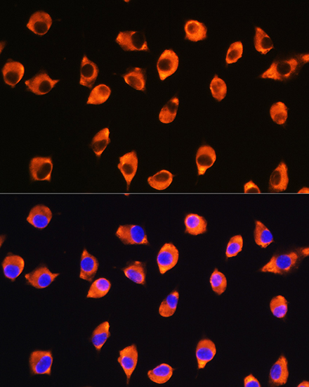 Immunofluorescence analysis of L929 cells using KIF21A Rabbit pAb  at dilution of 1:100