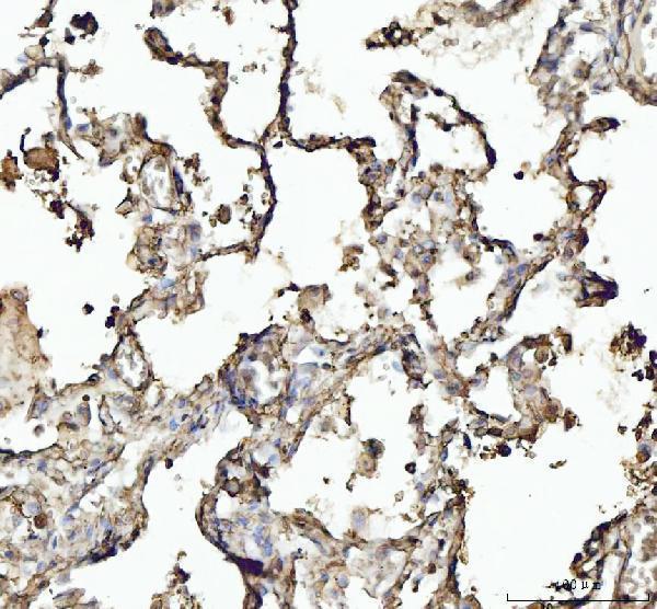  IHC analysis of Annexin VI/ANXA6 using anti-Annexin VI/ANXA6 antibody (A03735)