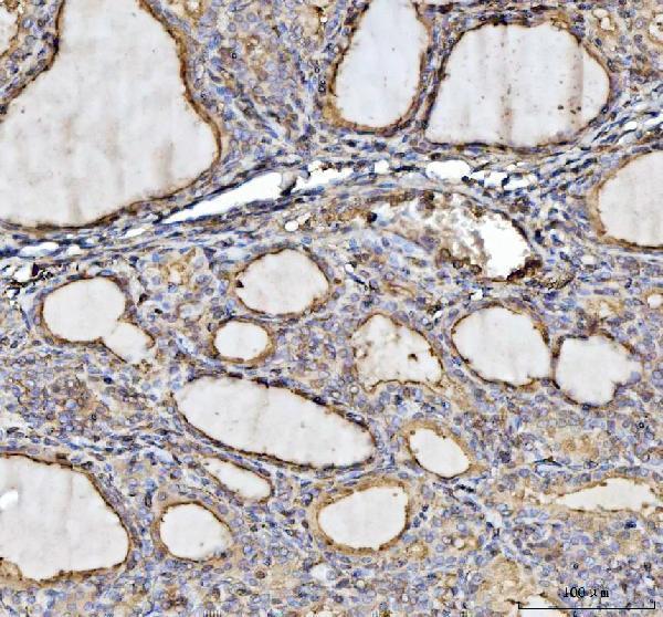  IHC analysis of Annexin VI/ANXA6 using anti-Annexin VI/ANXA6 antibody (A03735)