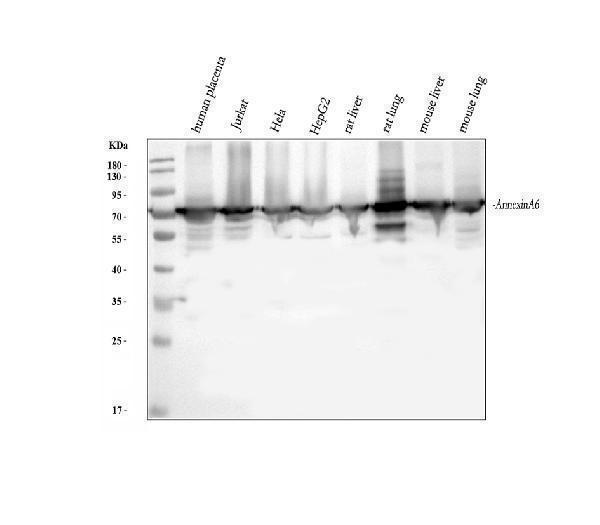 Western blot analysis of Annexin VI/ANXA6 using anti-Annexin VI/ANXA6 antibody (A03735)