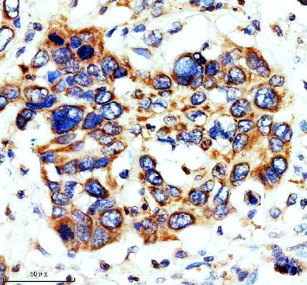 IHC analysis of CYTB using anti-CYTB antibody (A03737-2)