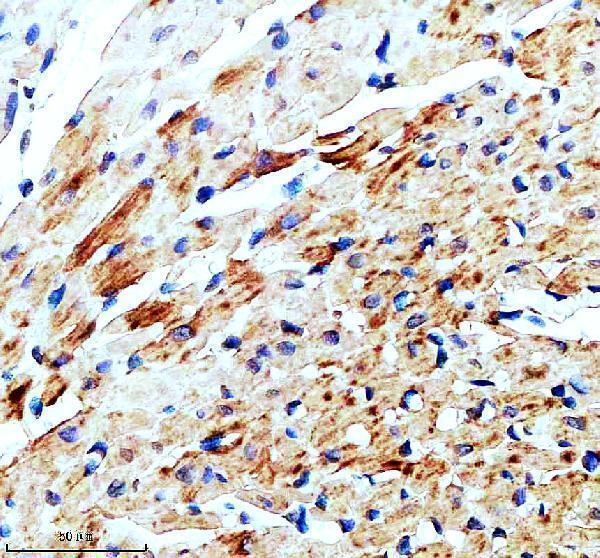 IHC analysis of CYTB using anti-CYTB antibody (A03737-2)