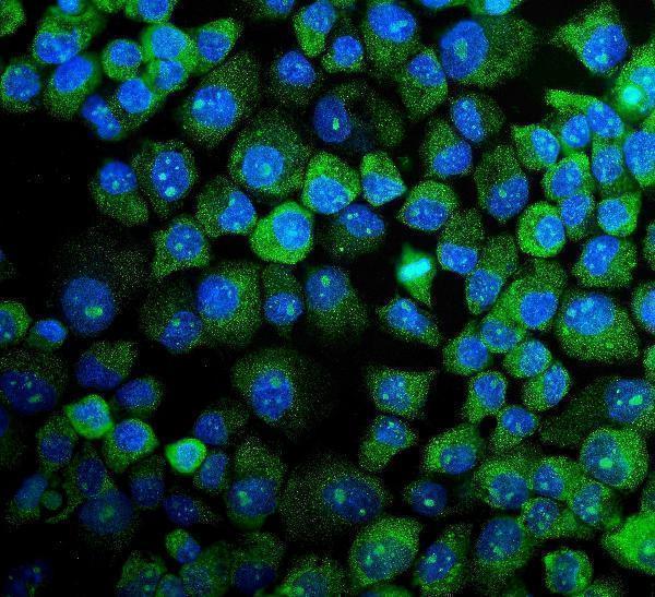 a03738 1 mapk11 primary antibodies if testing 3