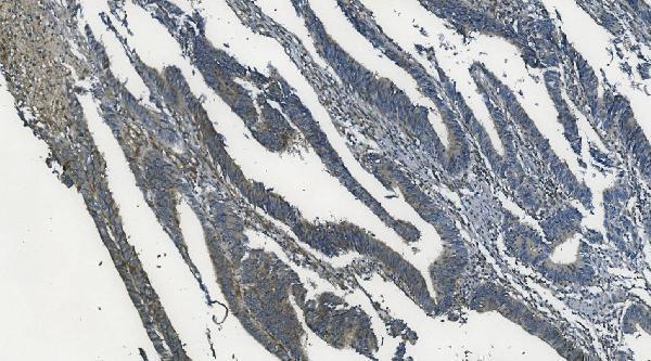 a03738 1 mapk11 primary antibodies ihc testing 2