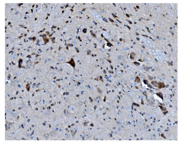a03738 1 mapk11 primary antibodies ihc testing 5