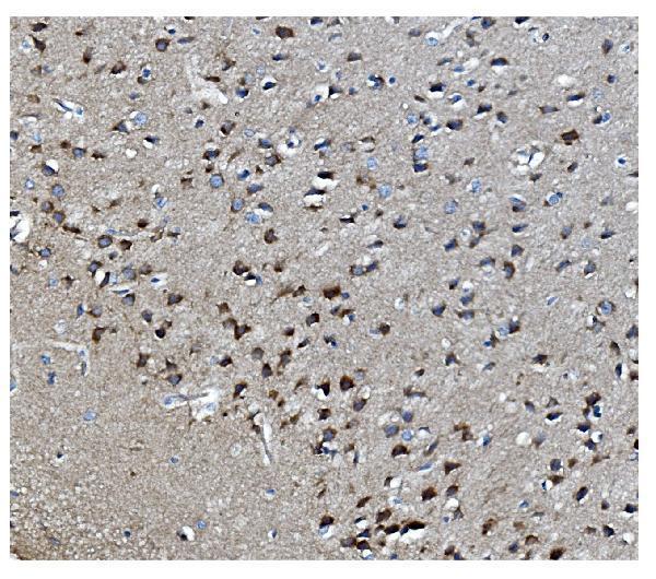 a03738 1 mapk11 primary antibodies ihc testing 6