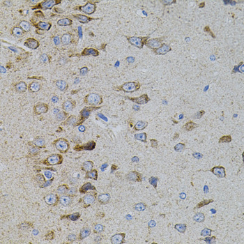 a03738 mapk11 primary antiboties ihc testing 2