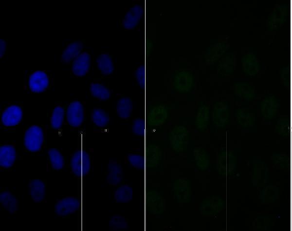 ICC staining BAF57 in HepG2 cells (green)