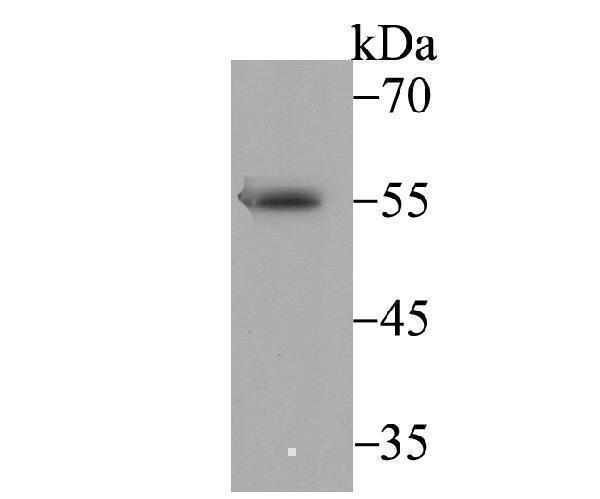 Western blot analysis of BAF57 on SH-SY-5Y cell lysate using anti-BAF57 antibody at 1/1,000 dilution