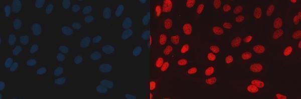 a03739 2 smarce1 primary antibodies if testing 4