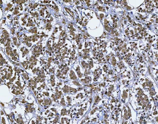  IHC analysis of BAF57/SMARCE1 using anti-BAF57/SMARCE1 antibody (A03739-2)