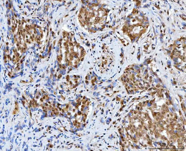  IHC analysis of BAF57/SMARCE1 using anti-BAF57/SMARCE1 antibody (A03739-2)
