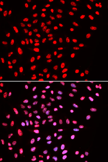 a03739 smarce1 primary antiboties if testing 3