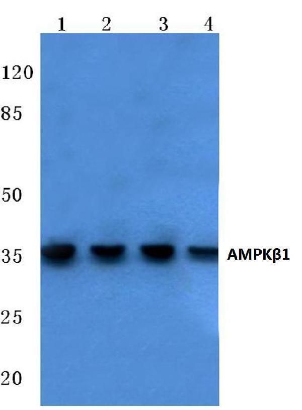 Western blot (WB) analysis of AMPKβ1 (V175) polyclonal antibody at 1:500 dilution
Lane1:Hela cell lysate
Lane2:HEK293T cell lysate
Lane3:NIH-3T3 cell lysate
Lane4:PC12 cell lysate