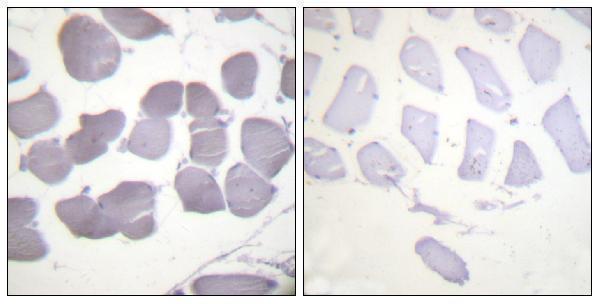 Immunohistochemistry analysis of paraffin-embedded human skeletal muscle, using AMPK beta1 (Phospho-Ser181) Antibody