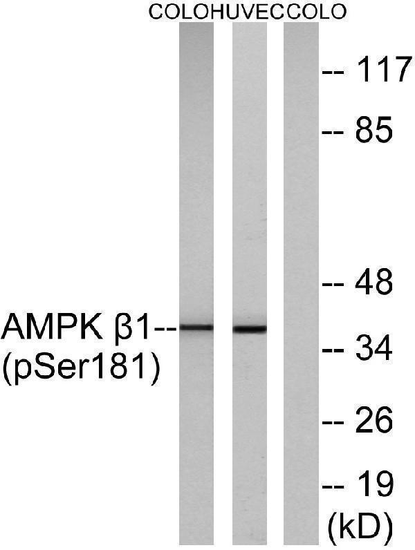 Western blot analysis of lysates from COLO205 cells and HUVEC cells, using AMPK beta1 (Phospho-Ser181) Antibody