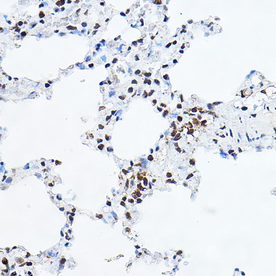Immunohistochemistry of paraffin-embedded rat lung using YEATS4 Rabbit pAb  at dilution of 1:100 