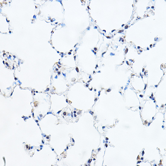 a03743 yeats4 primary antiboties ihc testing 4