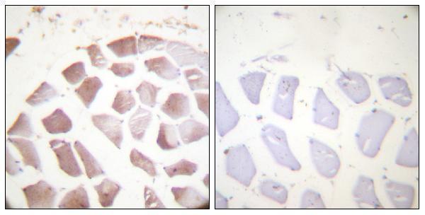 Immunohistochemistry analysis of paraffin-embedded human skeletal muscle, using Actin-pan (alpha/gamma) (Phospho-Tyr55/53) Antibody
