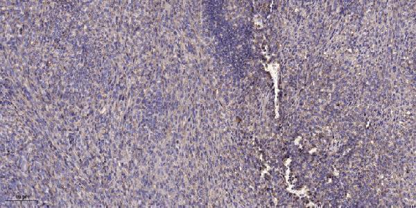 a03748 slc5a2 primary antibodies ihc testing 1