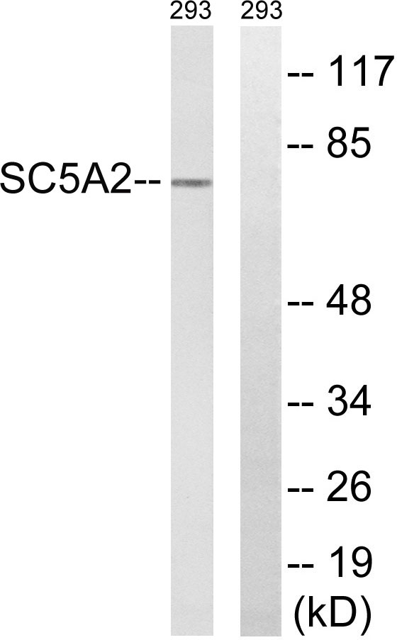 a03748 slc5a2 primary antibodies wb testing 2