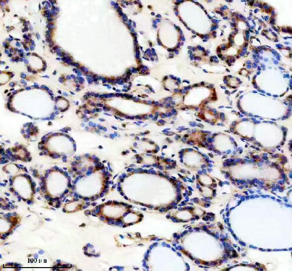 IHC analysis of TRIM32 using anti-TRIM32 antibody (A03750-1)