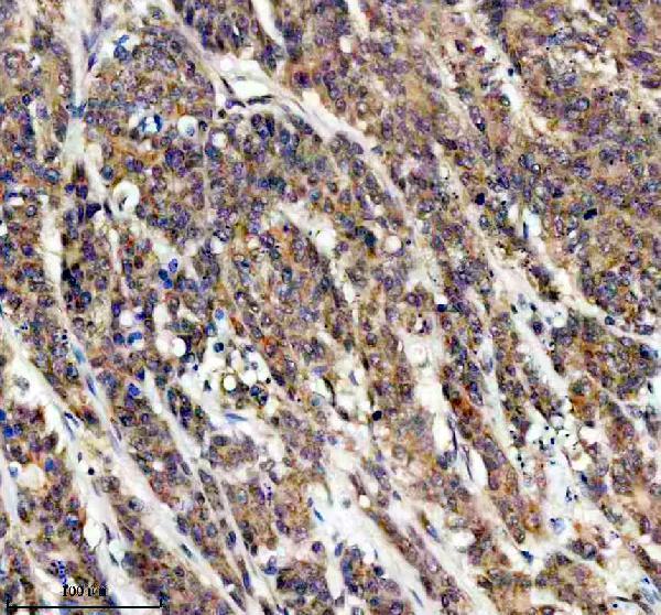 IHC analysis of TRIM32 using anti-TRIM32 antibody (A03750-1)