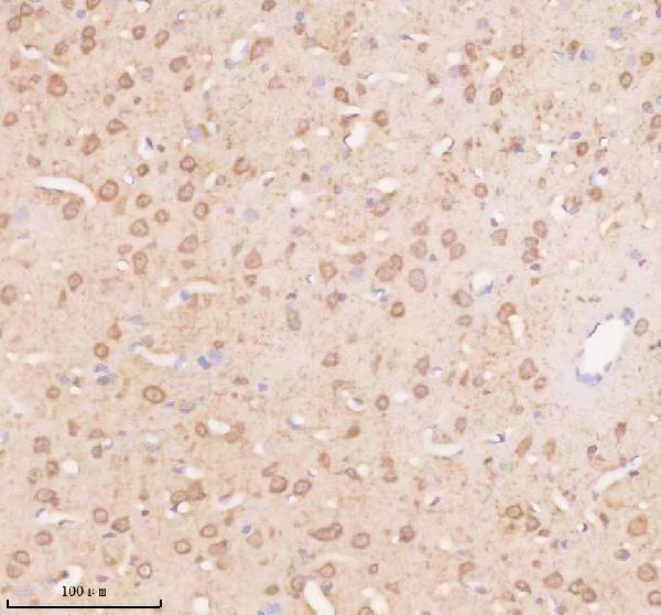 a03750 1 trim32 primary antibodies ihc testing 3