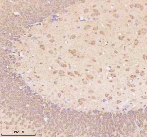 a03750 1 trim32 primary antibodies ihc testing 4