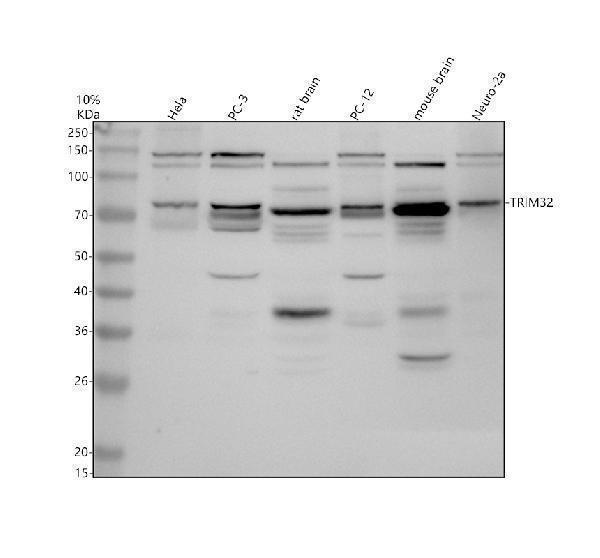 Western blot analysis of TRIM32 using anti-TRIM32 antibody (A03750-1)
