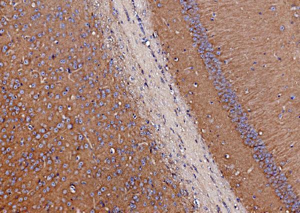 a03752 3 sv2a primary antibodies ihc testing 2