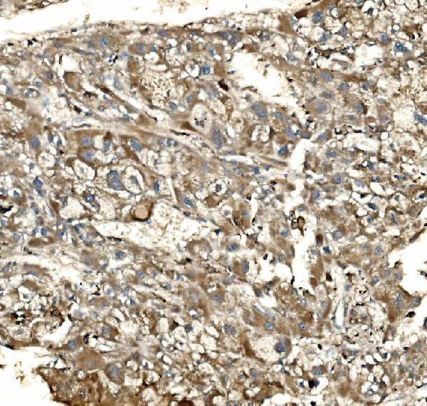 a03752 3 sv2a primary antibodies ihc testing 4