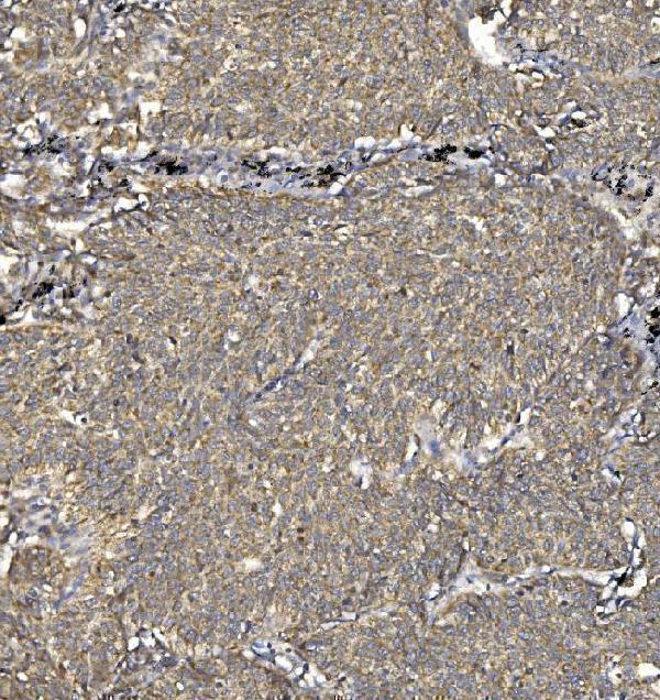 a03752 3 sv2a primary antibodies ihc testing 5