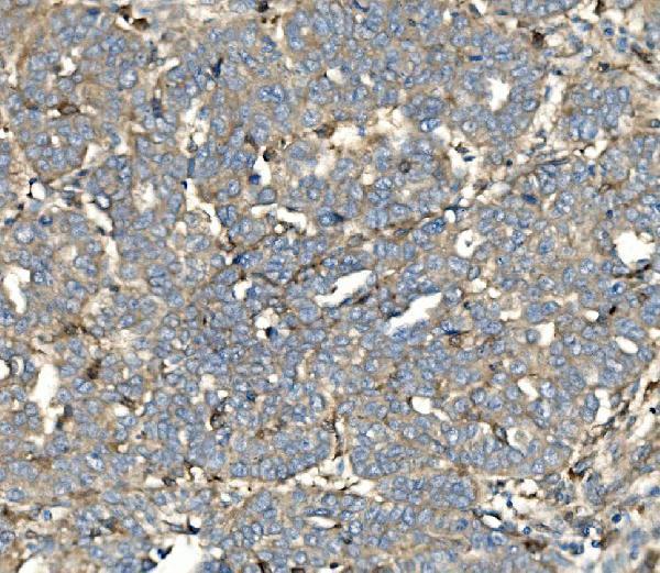 a03752 3 sv2a primary antibodies ihc testing 6