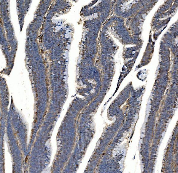 a03752 3 sv2a primary antibodies ihc testing 7