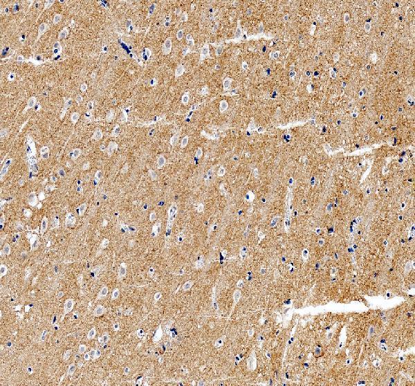 a03752 3 sv2a primary antibodies ihc testing 8