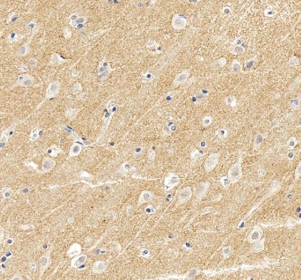 a03752 3 sv2a primary antibodies ihc testing 9