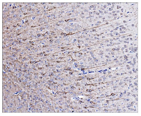 a03756 1 ina primary antibodies ihc testing 4