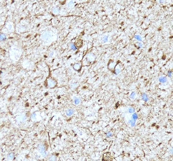 a03756 1 ina primary antibodies ihc testing 5