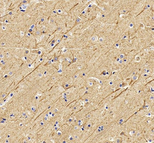 a03756 1 ina primary antibodies ihc testing 6