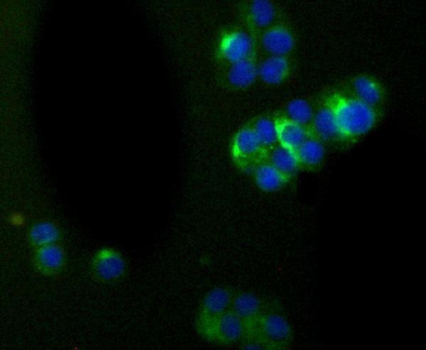 ICC staining alpha Internexin in PC-12 cells (green)