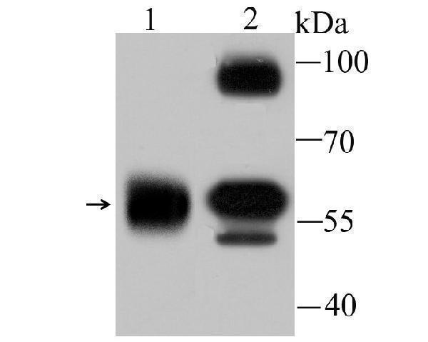 Western blot analysis of alpha Internexin on different lysates using anti-alpha Internexin antibody at 1/1,000 dilution
