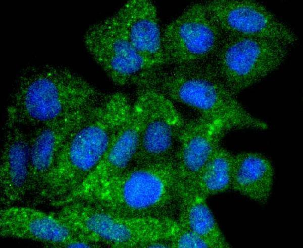 ICC staining ATG9A in Hela cells (green)
