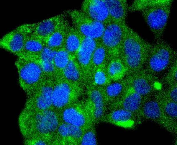 ICC staining ATG9A in 293 cells (green)